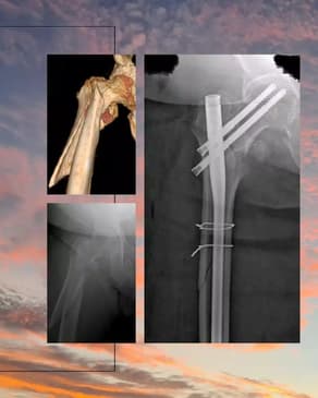 Slider image (10) Dr. Rodrigo Aguirre Rojas Orthopedic Surgeon in Mexico